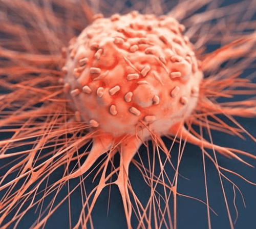 Breakthrough in Non-Invasive Cancer Treatment
